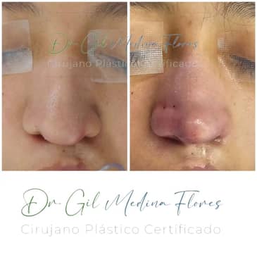 Slider image (6) Medina Flores Plastic Surgery